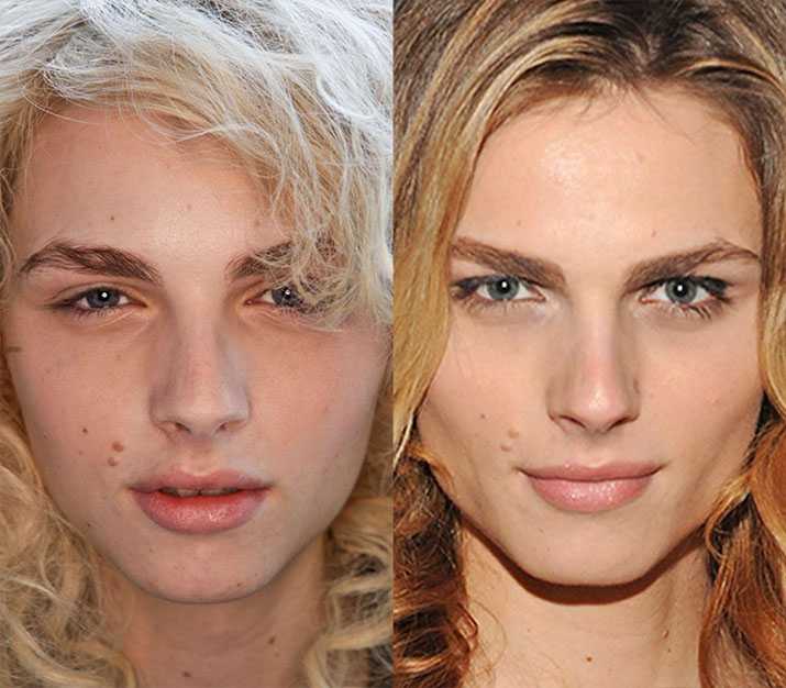 Операция по смене пола: фото до и после сменивших пол знаменитостей